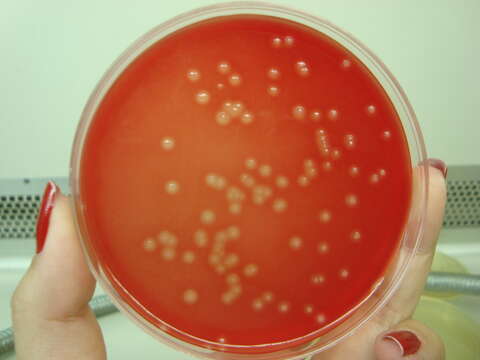 Plancia ëd Streptococcus agalactiae