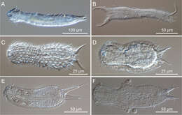 Image of gastrotrichs