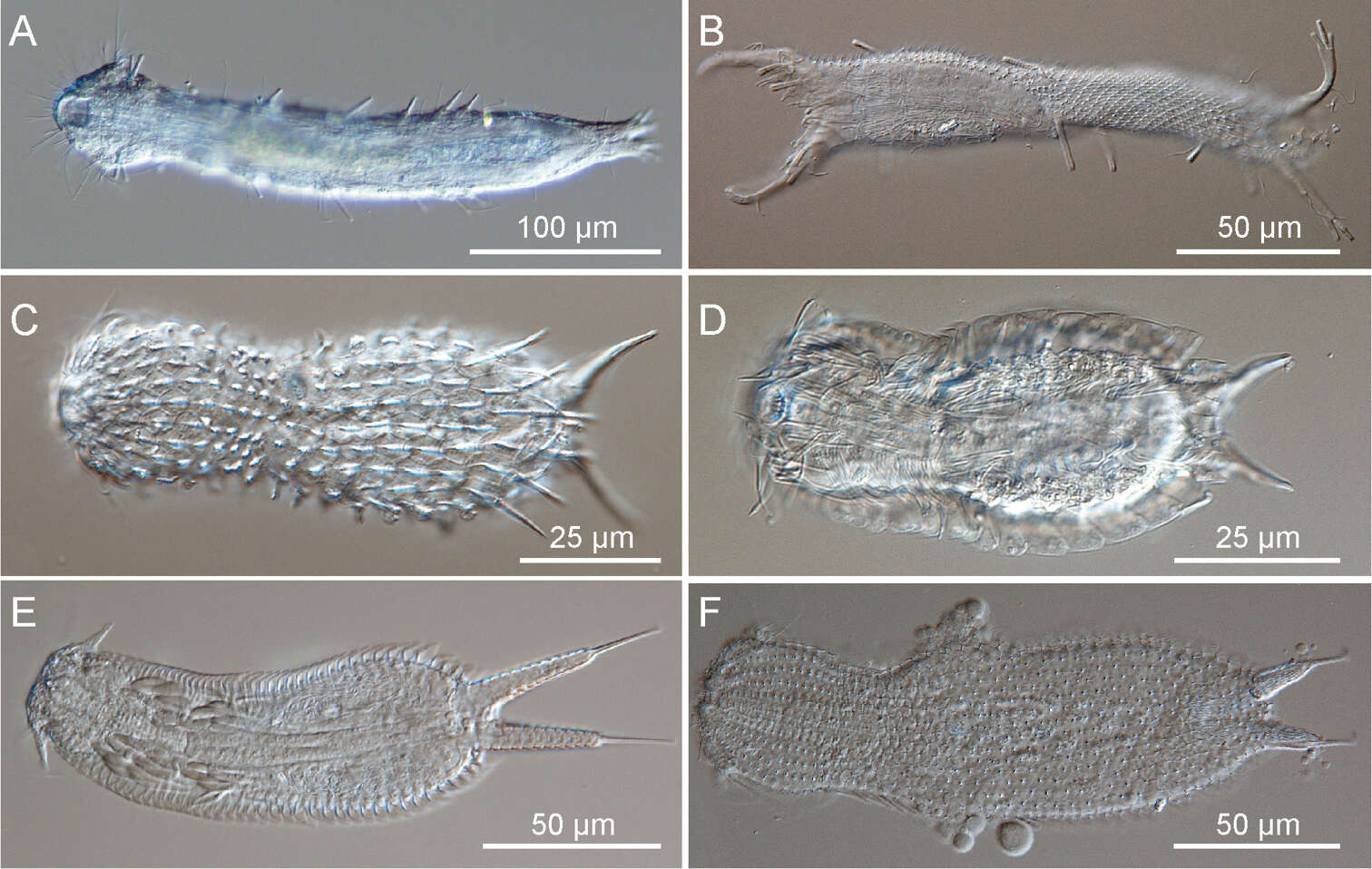 Image of gastrotrichs