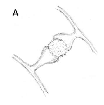 Image of Mortierella