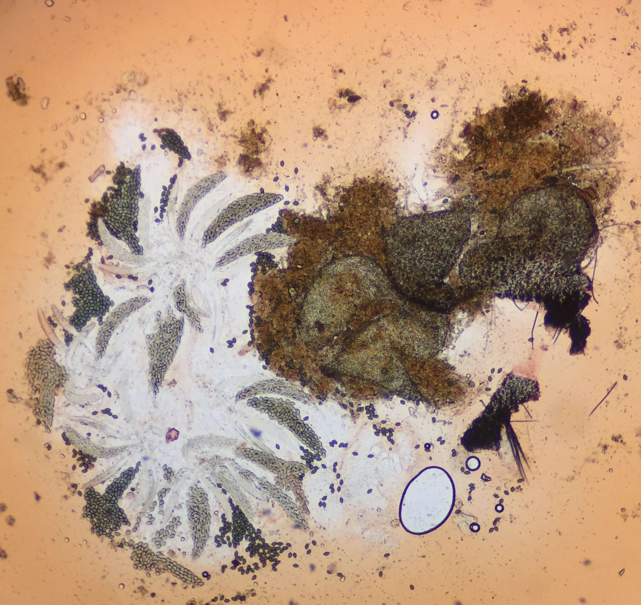 Image of Podospora setosa (G. Winter) Niessl 1883