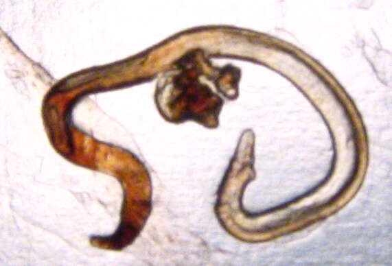 Image of nematodes