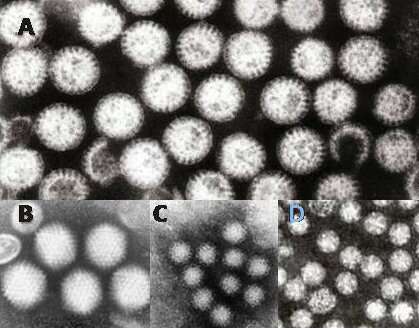 Image of Astrovirus