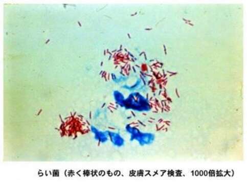 Sivun Mycobacterium leprae kuva