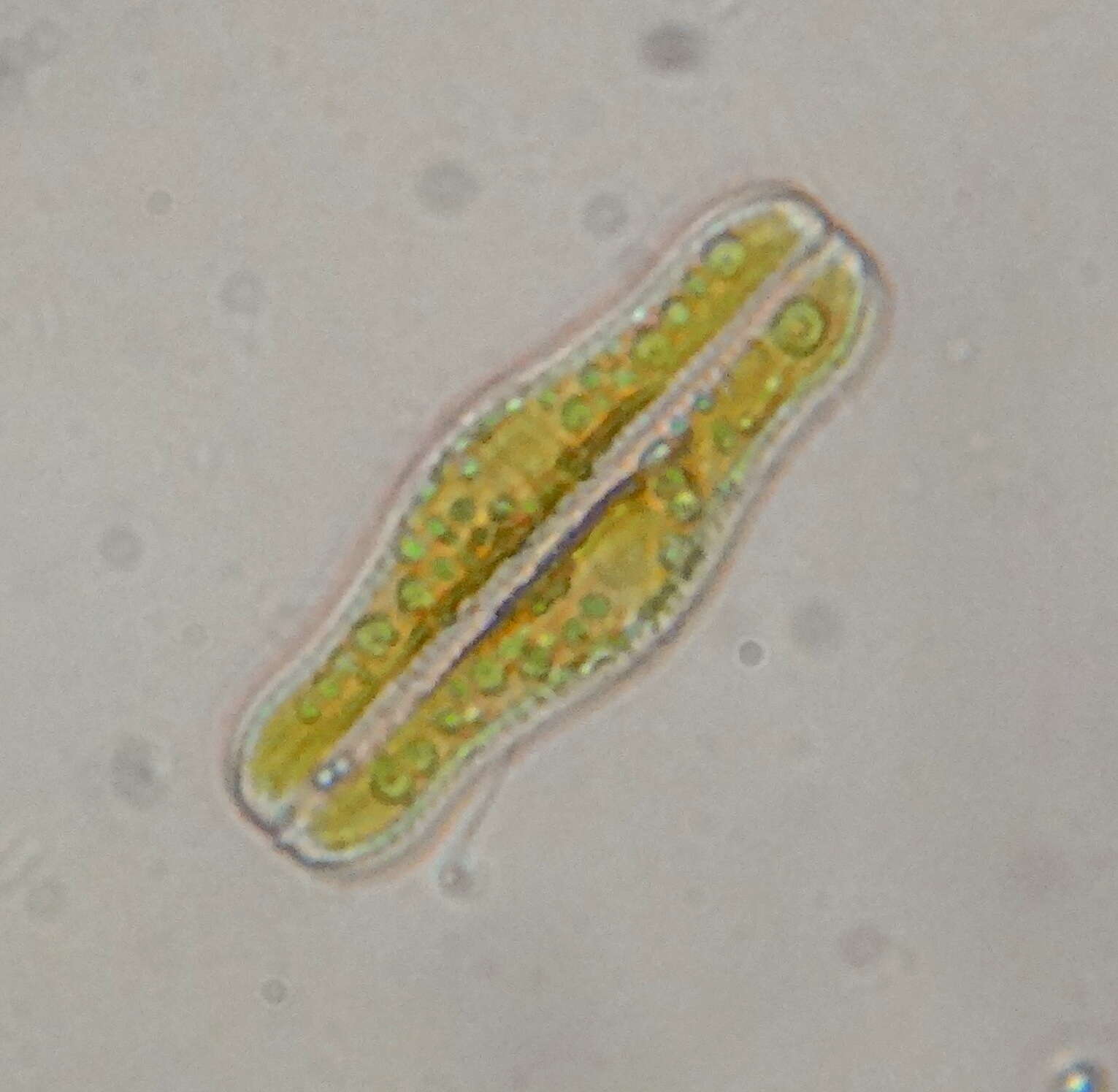 Image of <i>Epithemia gibba</i> Kützing