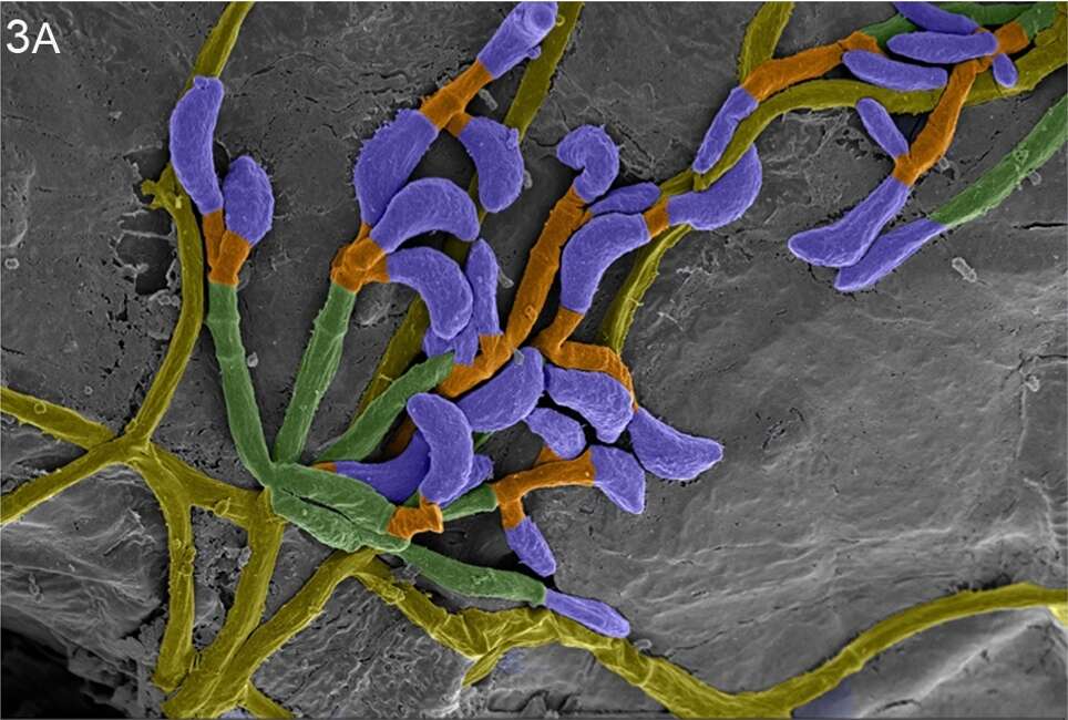 Image de Pseudogymnoascus destructans (Blehert & Gargas) Minnis & D. L. Lindner 2013