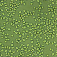 Слика од Candida glabrata (H. W. Anderson) S. A. Mey. & Yarrow 1978