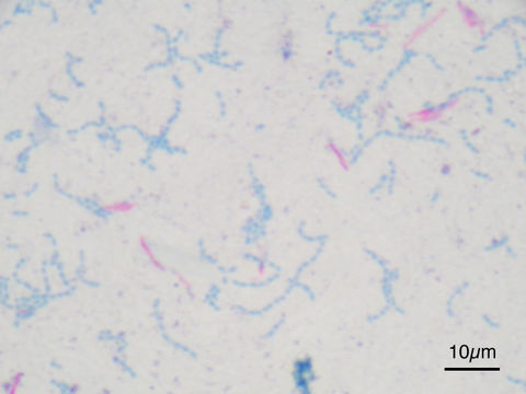 Image of <i>Mycobacterium bovis</i>