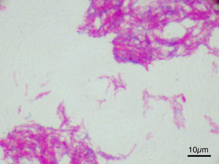 Image of Mycobacterium bovis