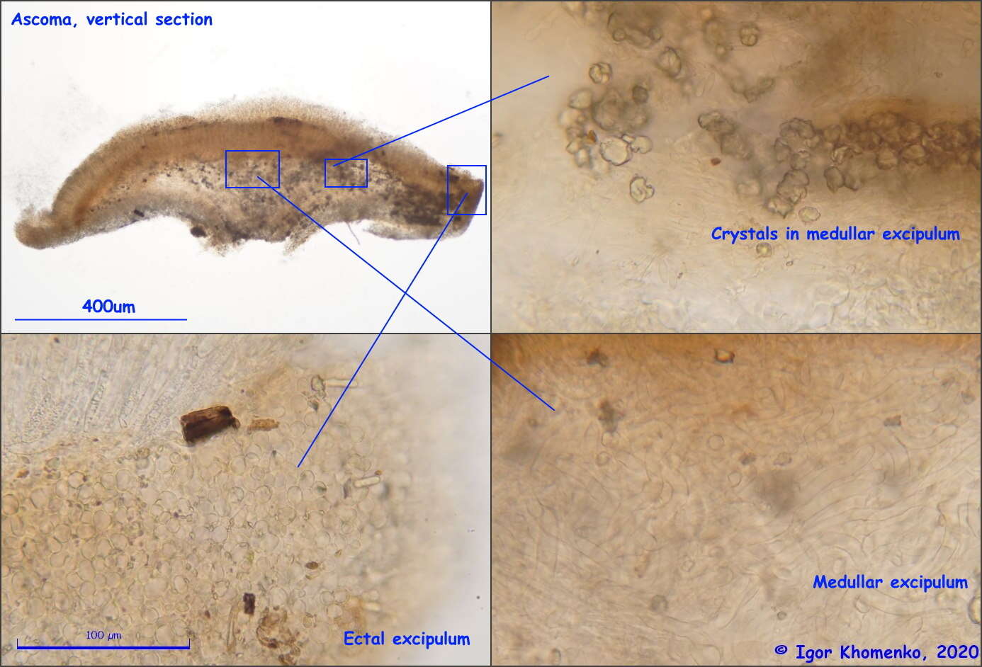 صورة Ciborinia pseudobifrons Whetzel ex J. W. Groves & Bowerman 1955