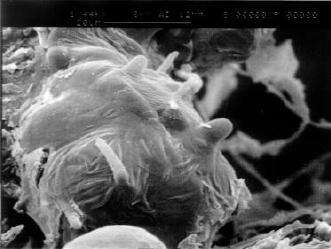 Image of Macrophomina phaseolina (Tassi) Goid. 1947