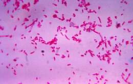Image of Fusobacteriaceae