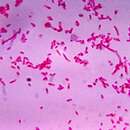 Image de Fusobacterium