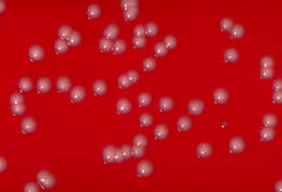 Image of coryneform bacteria