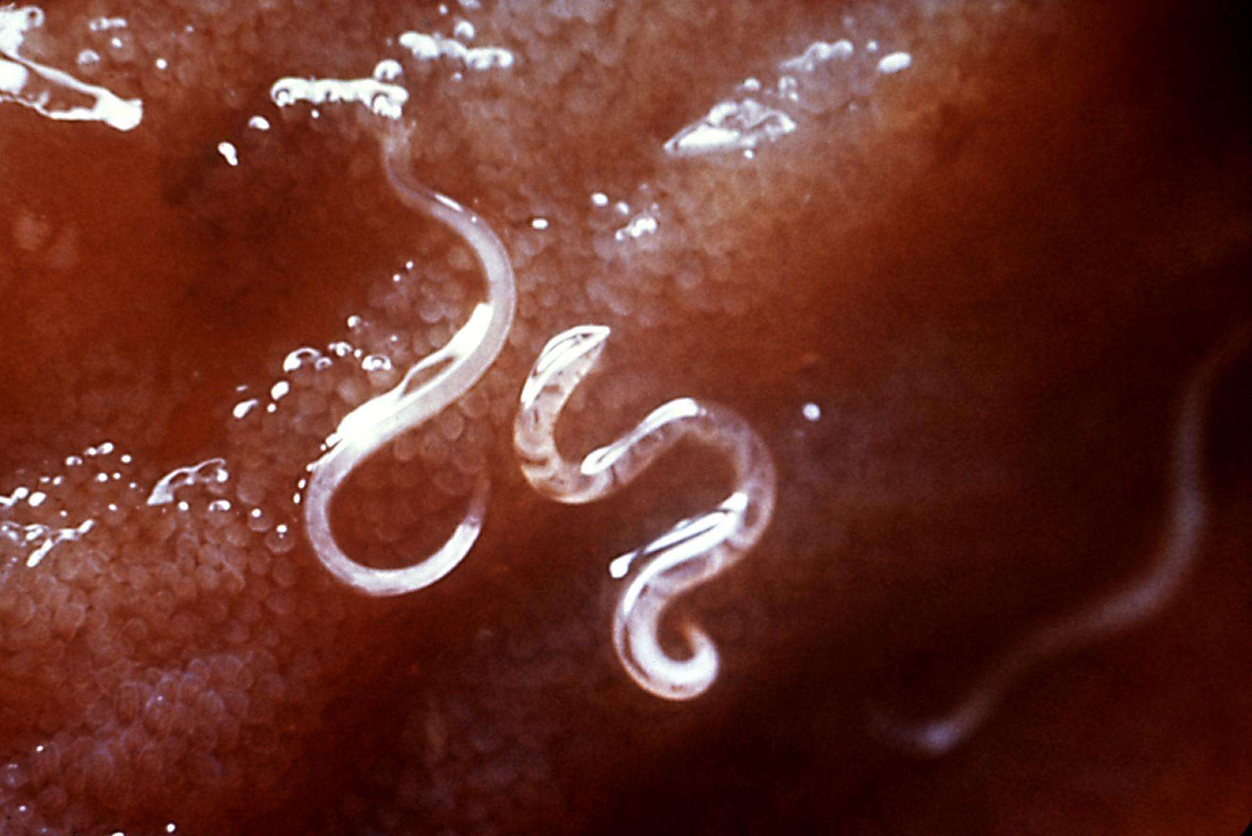 Image of Ancylostoma caninum