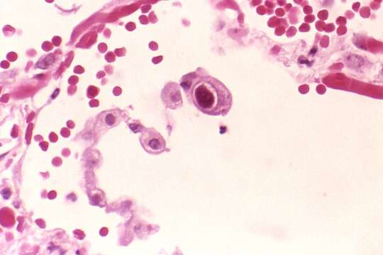 Image of Cytomegalovirus