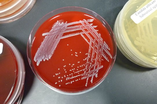 Image of <i>Staphylococcus epidermidis</i>
