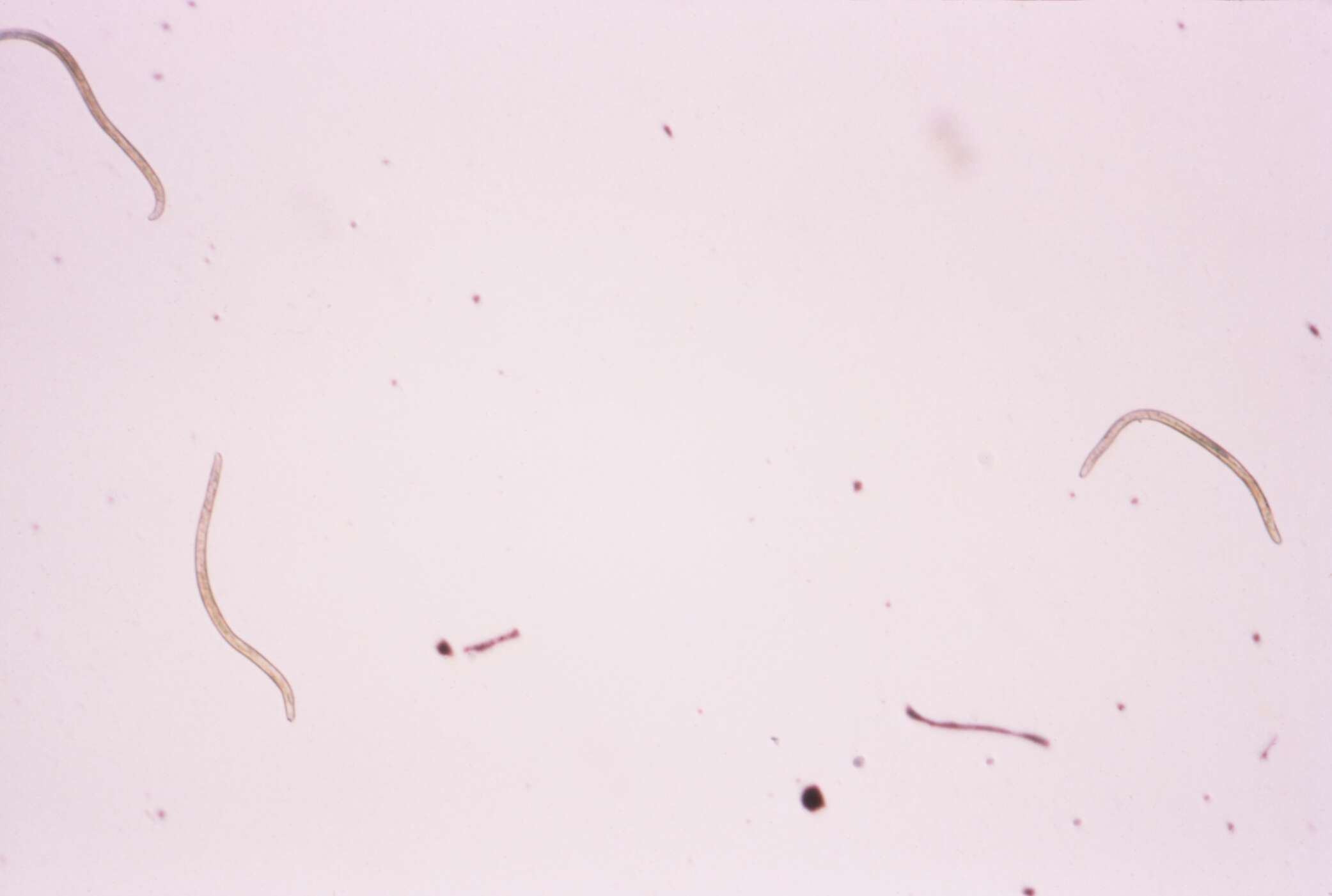 Image of Spiruria