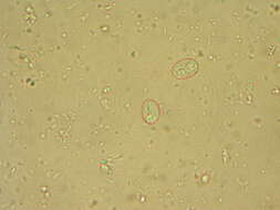 Слика од Giardia intestinalis