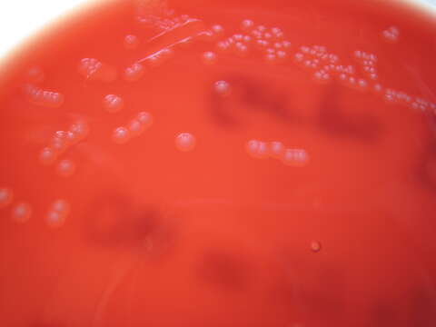 Image of Streptococcus agalactiae