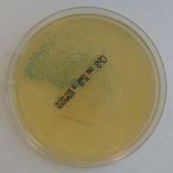 Image of Streptococcus agalactiae