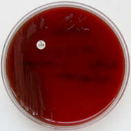 Image of Bacteroides fragilis