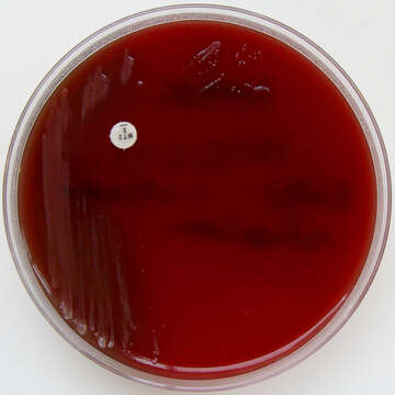 Image of Bacteroides fragilis