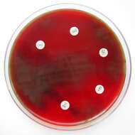 Image de Streptococcus pneumoniae