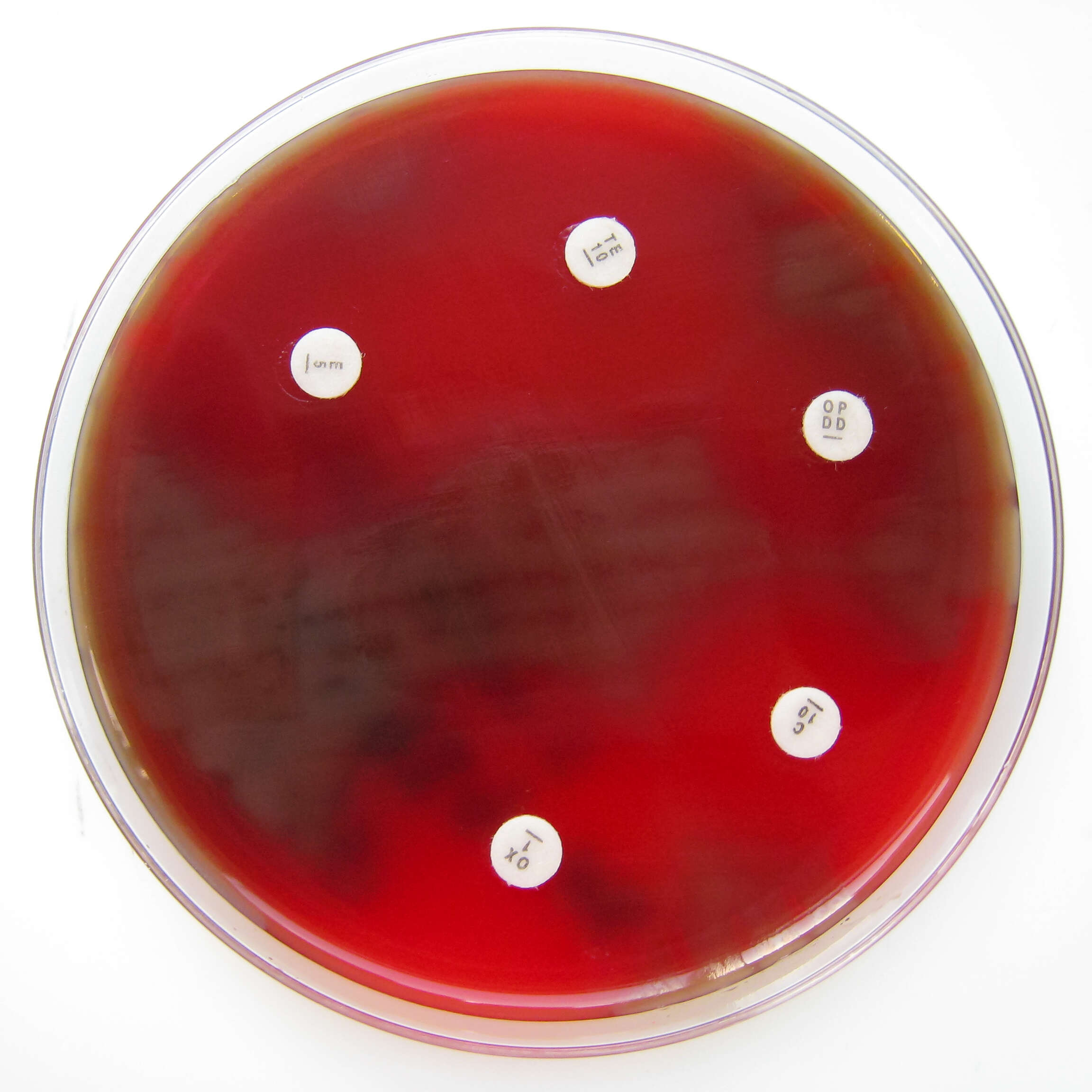 Image de Streptococcus pneumoniae