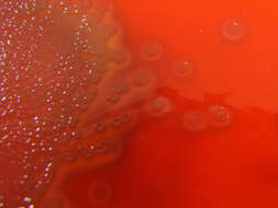 Image de Streptococcus pneumoniae