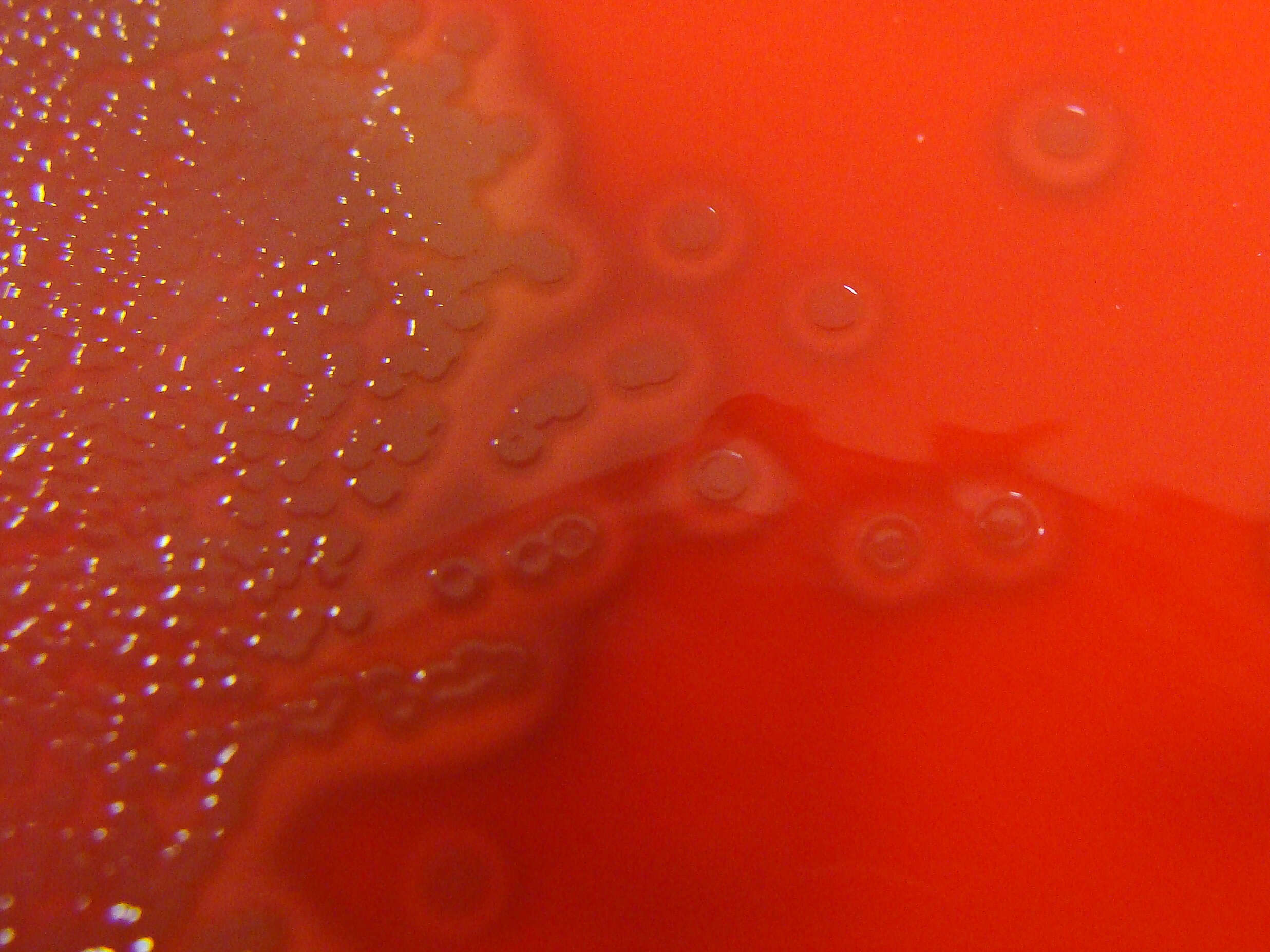 Image de Streptococcus pneumoniae