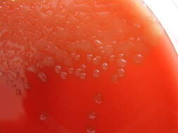 Image de Streptococcus pneumoniae