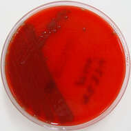 Imagem de Streptococcus pneumoniae