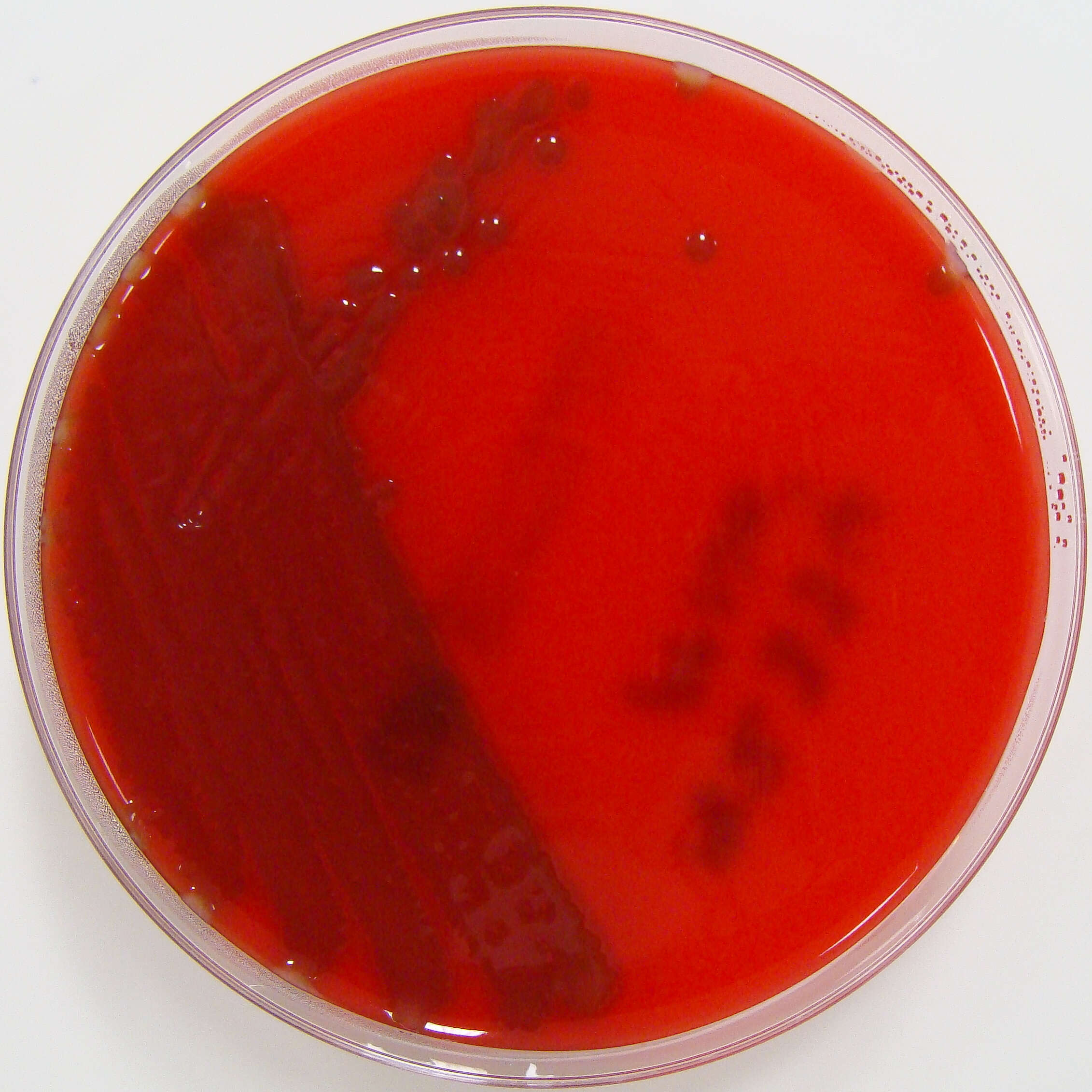 Image of Streptococcus pneumoniae