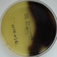Image of <i>Listeria monocytogenes</i>