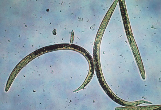 Image of Dictyocaulus