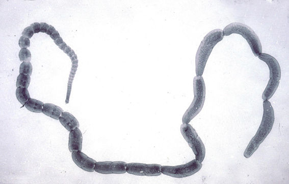Image of Double-pored Dog Tapeworm
