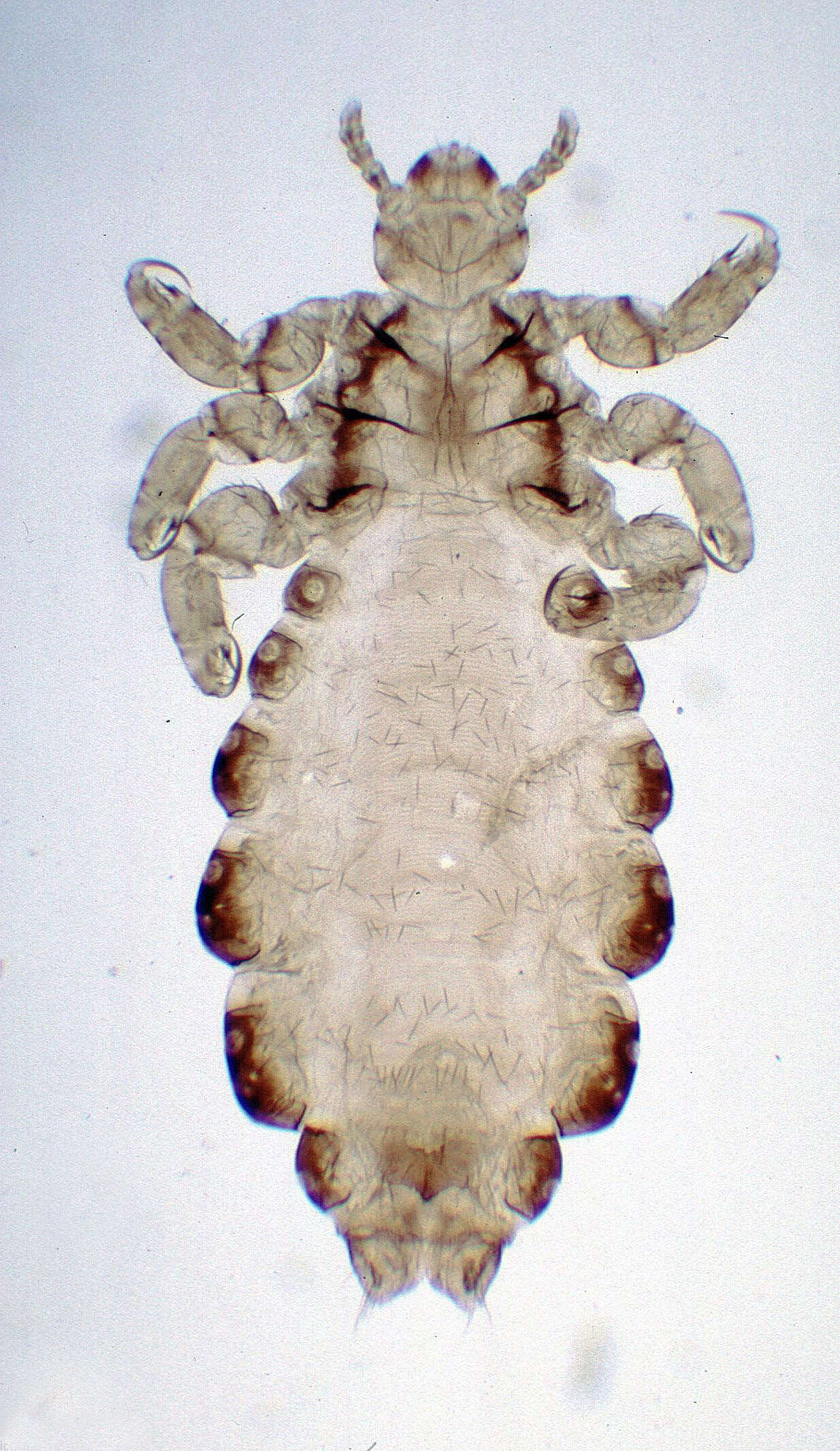 Pediculus humanus humanus Linnaeus 1758 resmi