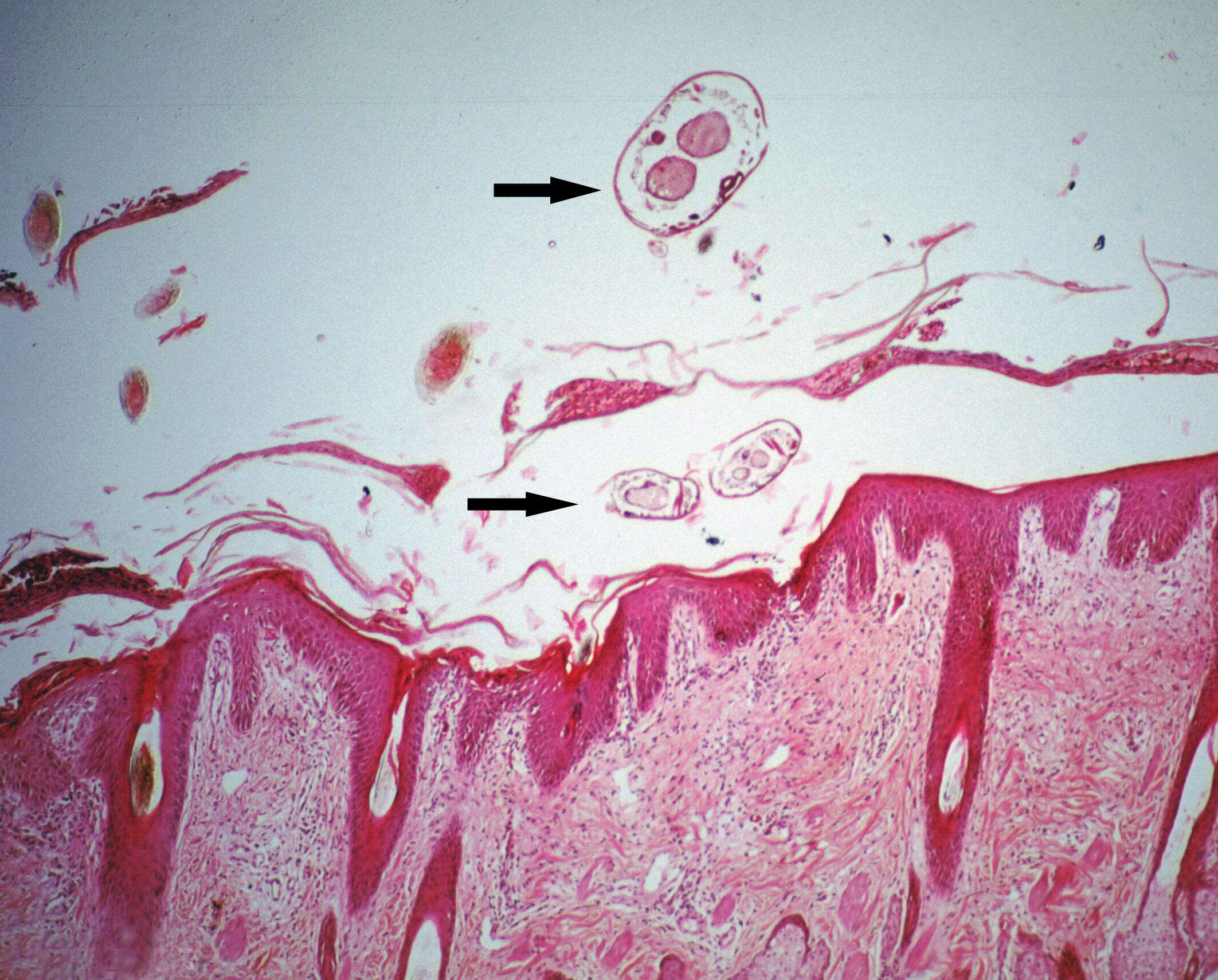 Image of Psoroptes