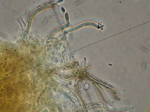 Image de Aureobasidium apocryptum (Ellis & Everh.) Herm.-Nijh. 1977