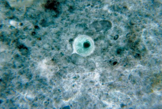 Image of <i>Entamoeba histolytica</i>