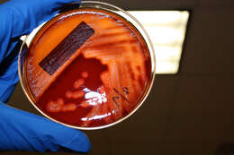 Image of Streptococcus pyogenes