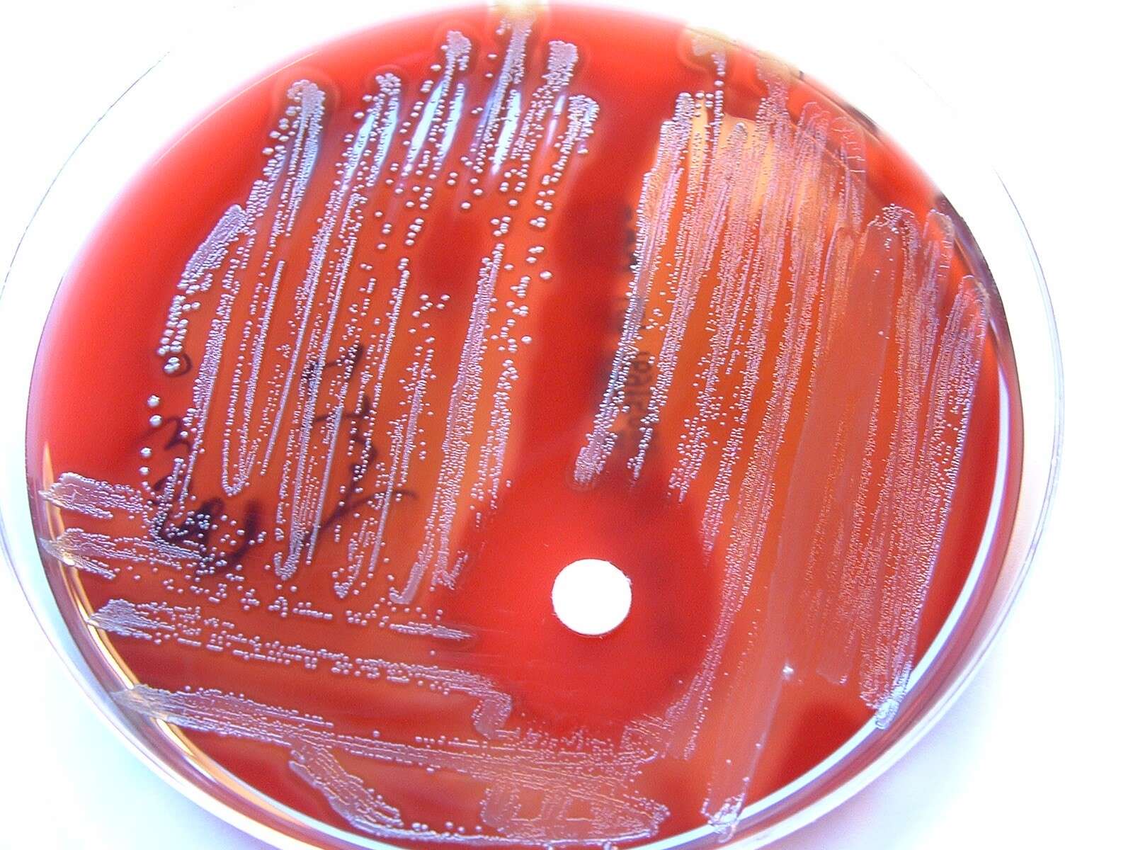 Image of Streptococcus pyogenes