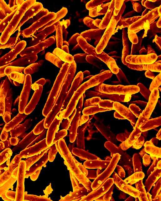 Imagem de 'Mycobacterium tuberculosis complex'