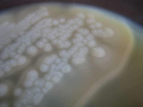 Image de Clostridium botulinum