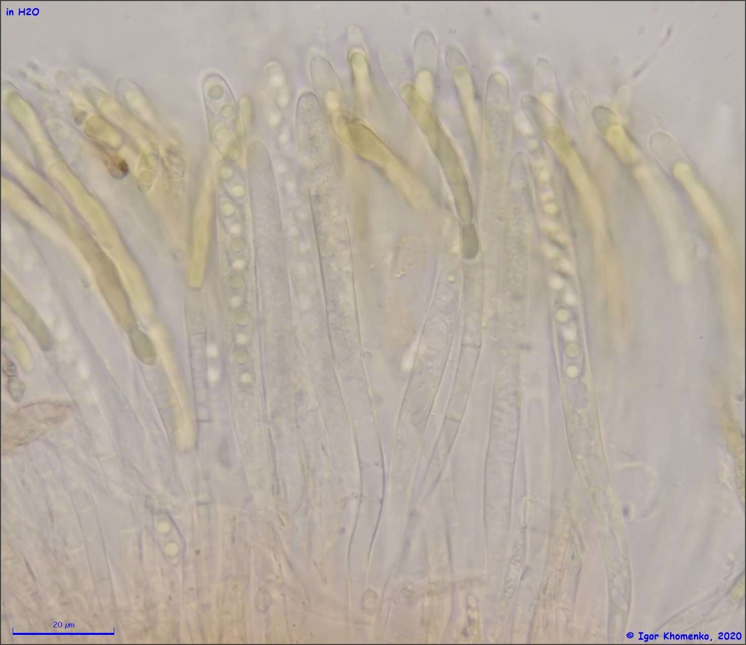 Image of Chlorencoelia torta (Schwein.) J. R. Dixon 1975