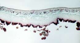 Image of navel lichen