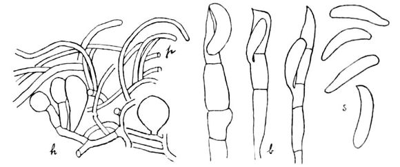 Image of <i>Septobasidium pseudopedicellatum</i> Burt 1916