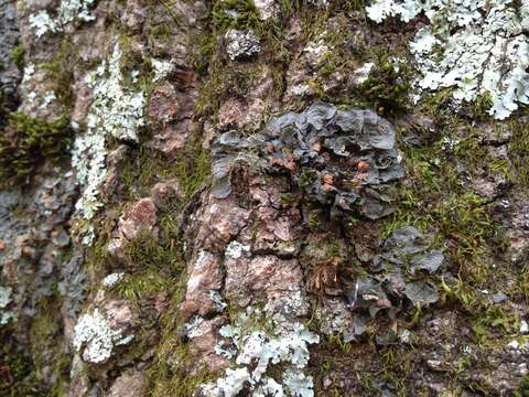 Image of skin lichen