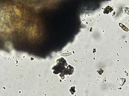 Image of Cresponea chloroconia (Tuck.) Egea & Torrente